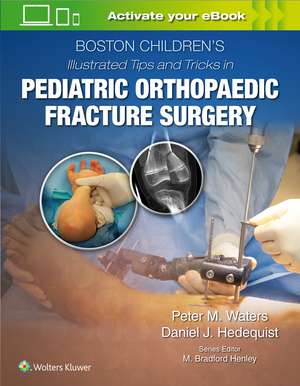 Boston Children’s Illustrated Tips and Tricks in Pediatric Orthopaedic Fracture Surgery de Peter M Waters MD