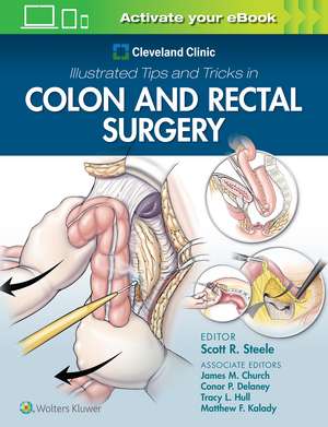 Cleveland Clinic Illustrated Tips and Tricks in Colon and Rectal Surgery de Scott Steele