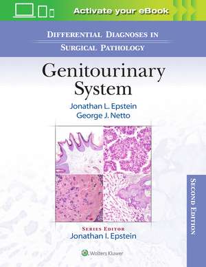 Differential Diagnoses in Surgical Pathology: Genitourinary System de Jonathan Epstein MD