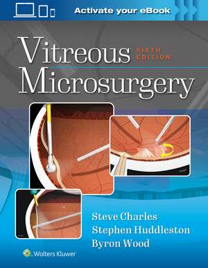 Vitreous Microsurgery de Steve Charles MD