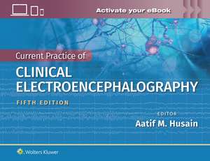 Current Practice of Clinical Electroencephalography de Dr. Aatif M. Husain MD