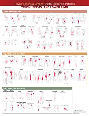 Travell, Simons & Simons’ Trigger Point Pain Patterns Wall Chart: Trunk, Pelvis, and Lower Limb de Anatomical Chart Company