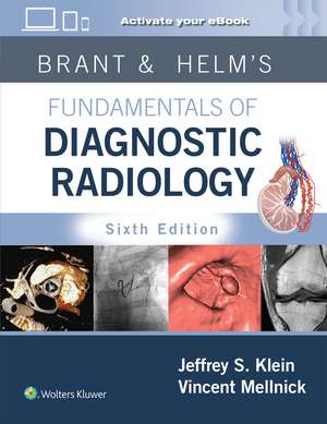 Brant & Helms' Fundamentals of Diagnostic Radiology: Print + eBook with Multimedia de Jeffrey Klein MD, FACR