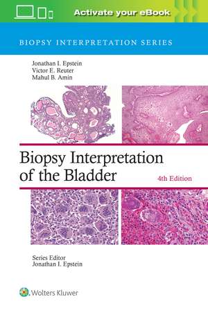 Biopsy Interpretation of the Bladder: Print + eBook with Multimedia de Jonathan I. Epstein