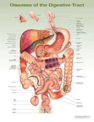 Diseases of the Digestive Tract Anatomical Chart de Anatomical Chart Company