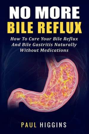 No More Bile Reflux de Paul Higgins