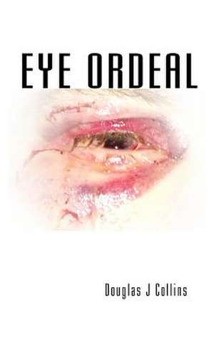 Eye Ordeal de Collins, Douglas J.