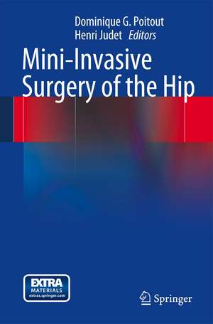 Mini-Invasive Surgery of the Hip de Dominique G. Poitout