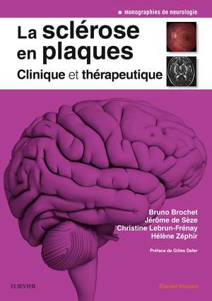 La sclérose en plaques - Clinique et thérapeutique de Bruno Brochet