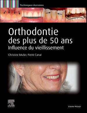 Orthodontie des plus de 50 ans: Influence du vieillissement de Pierre Canal