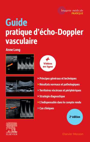 Guide pratique d'écho-Doppler vasculaire de Anne Long