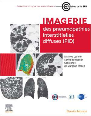 Imagerie des pneumopathies interstitielles diffuses (PID) de Mathieu Lederlin