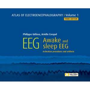 Atlas of Electroencephalography -- Volume 1 Awake and sleep EEG de Philippe Gelisse