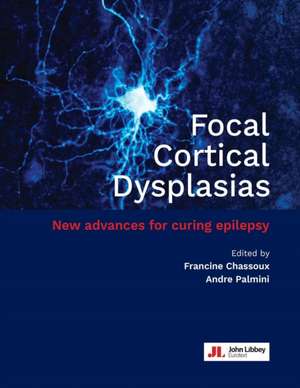 Focal Cortical Dysplasias: New advances for curing epilepsy de Francine Chassoux