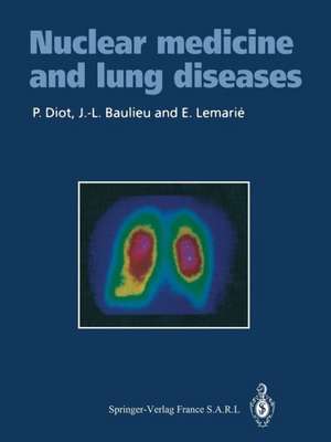 Nuclear medicine and lung diseases de Patrice Diot