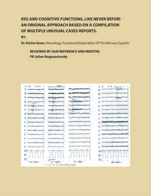 Eeg and Cognitive Functions, Like Never Befor!: An Original Approach Based on a Compilation of Multiple Unusual Cases Reports de Amine Guen