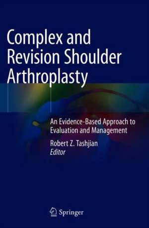 Complex and Revision Shoulder Arthroplasty: An Evidence-Based Approach to Evaluation and Management de Robert Z. Tashjian