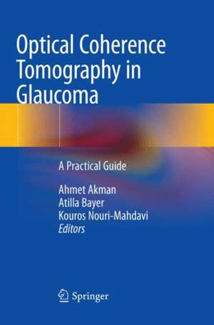 Optical Coherence Tomography in Glaucoma: A Practical Guide de Ahmet Akman