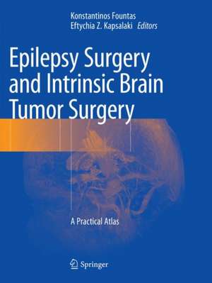 Epilepsy Surgery and Intrinsic Brain Tumor Surgery: A Practical Atlas de Konstantinos Fountas