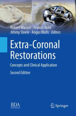 Extra-Coronal Restorations: Concepts and Clinical Application de Robert Wassell