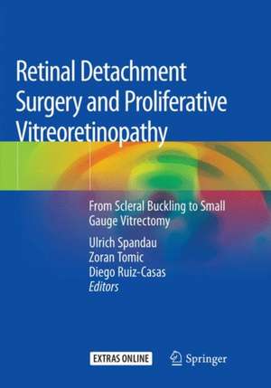 Retinal Detachment Surgery and Proliferative Vitreoretinopathy: From Scleral Buckling to Small Gauge Vitrectomy de Ulrich Spandau