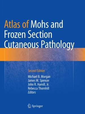 Atlas of Mohs and Frozen Section Cutaneous Pathology de Michael B. Morgan