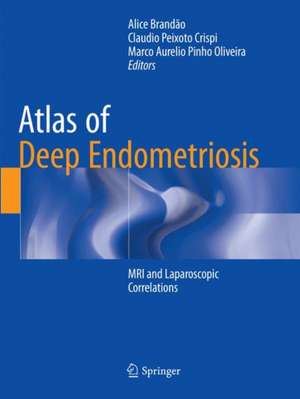 Atlas of Deep Endometriosis: MRI and Laparoscopic Correlations de Alice Brandão