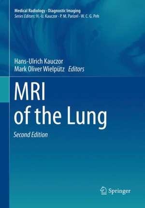 MRI of the Lung de Hans-Ulrich Kauczor