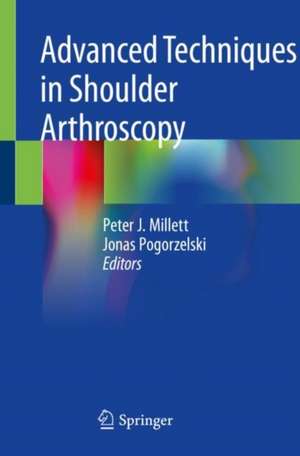 Advanced Techniques in Shoulder Arthroscopy de Peter J. Millett