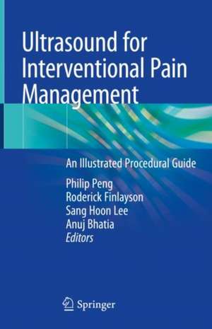 Ultrasound for Interventional Pain Management: An Illustrated Procedural Guide de Philip Peng