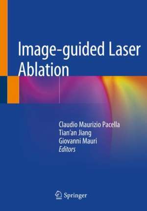 Image-guided Laser Ablation de Claudio Maurizio Pacella