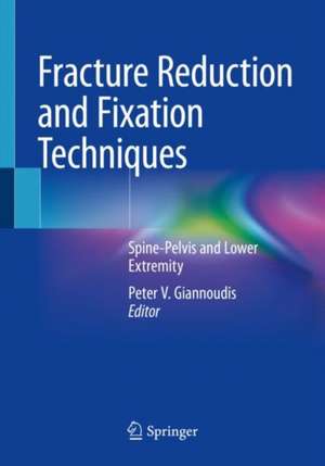 Fracture Reduction and Fixation Techniques: Spine-Pelvis and Lower Extremity de Peter V. Giannoudis