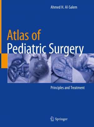 Atlas of Pediatric Surgery: Principles and Treatment de Ahmed H. Al-Salem