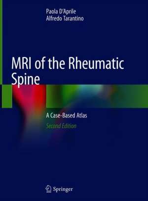 MRI of the Rheumatic Spine: A Case-Based Atlas de Paola D'Aprile