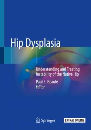 Hip Dysplasia: Understanding and Treating Instability of the Native Hip de Paul E. Beaulé