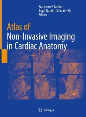 Atlas of Non-Invasive Imaging in Cardiac Anatomy de Francesco F. Faletra