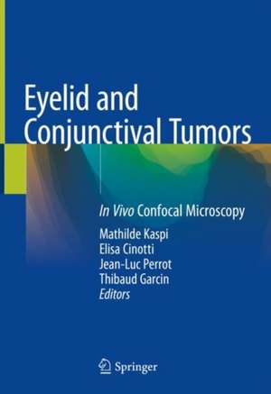 Eyelid and Conjunctival Tumors: In Vivo Confocal Microscopy de Mathilde Kaspi