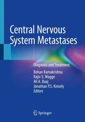 Central Nervous System Metastases: Diagnosis and Treatment de Rohan Ramakrishna