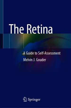 The Retina: A Guide to Self-Assessment de Melvin J. Gouder