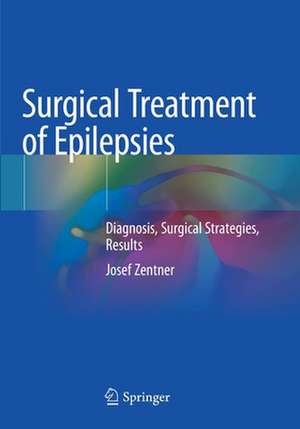 Surgical Treatment of Epilepsies: Diagnosis, Surgical Strategies, Results de Josef Zentner