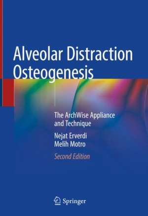 Alveolar Distraction Osteogenesis: The ArchWise Appliance and Technique de Nejat Erverdi