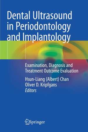 Dental Ultrasound in Periodontology and Implantology: Examination, Diagnosis and Treatment Outcome Evaluation de Hsun-Liang (Albert) Chan