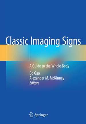 Classic Imaging Signs: A Guide to the Whole Body de Bo Gao