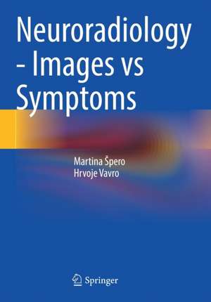 Neuroradiology - Images vs Symptoms de Martina Špero