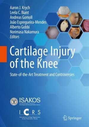 Cartilage Injury of the Knee: State-of-the-Art Treatment and Controversies de Aaron J. Krych