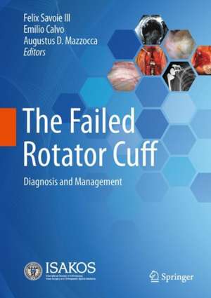 The Failed Rotator Cuff: Diagnosis and Management de Felix H. Savoie III