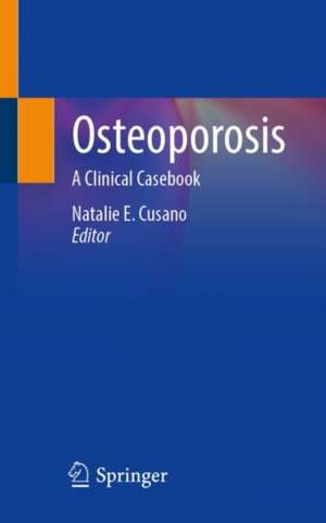 Osteoporosis: A Clinical Casebook de Natalie E. Cusano