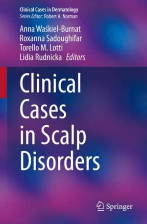 Clinical Cases in Scalp Disorders de Anna Waśkiel-Burnat