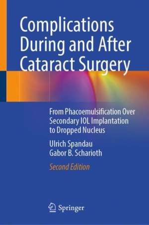 Complications During and After Cataract Surgery: From Phacoemulsification Over Secondary IOL Implantation to Dropped Nucleus de Ulrich Spandau