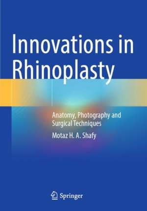 Innovations in Rhinoplasty: Anatomy, Photography and Surgical Techniques de Motaz H. A. Shafy